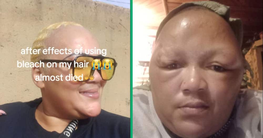 woman shares damaged suffered from bleaching hair