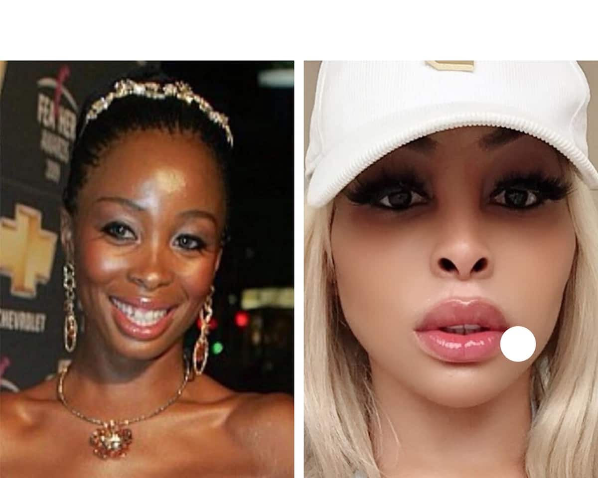 Sa Celebrities Before And After Plastic Surgery Photos South Africa ...