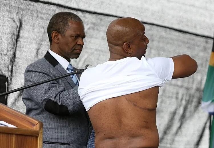 Prince Zulu displayed the large scars on his body caused by TB. Source: Sowetan Live