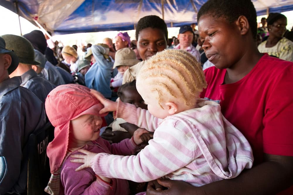 In some parts of Africa, people with albinism run the gauntlet of discrimination and even murder. Picture: children at an albinism awareness event in Malawi in 2015