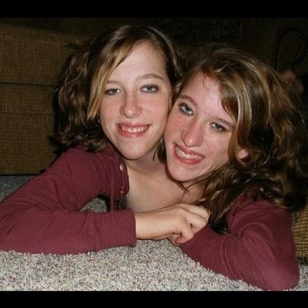 Conjoined twins Abby and Brittany Hensel: Where are they today? -  