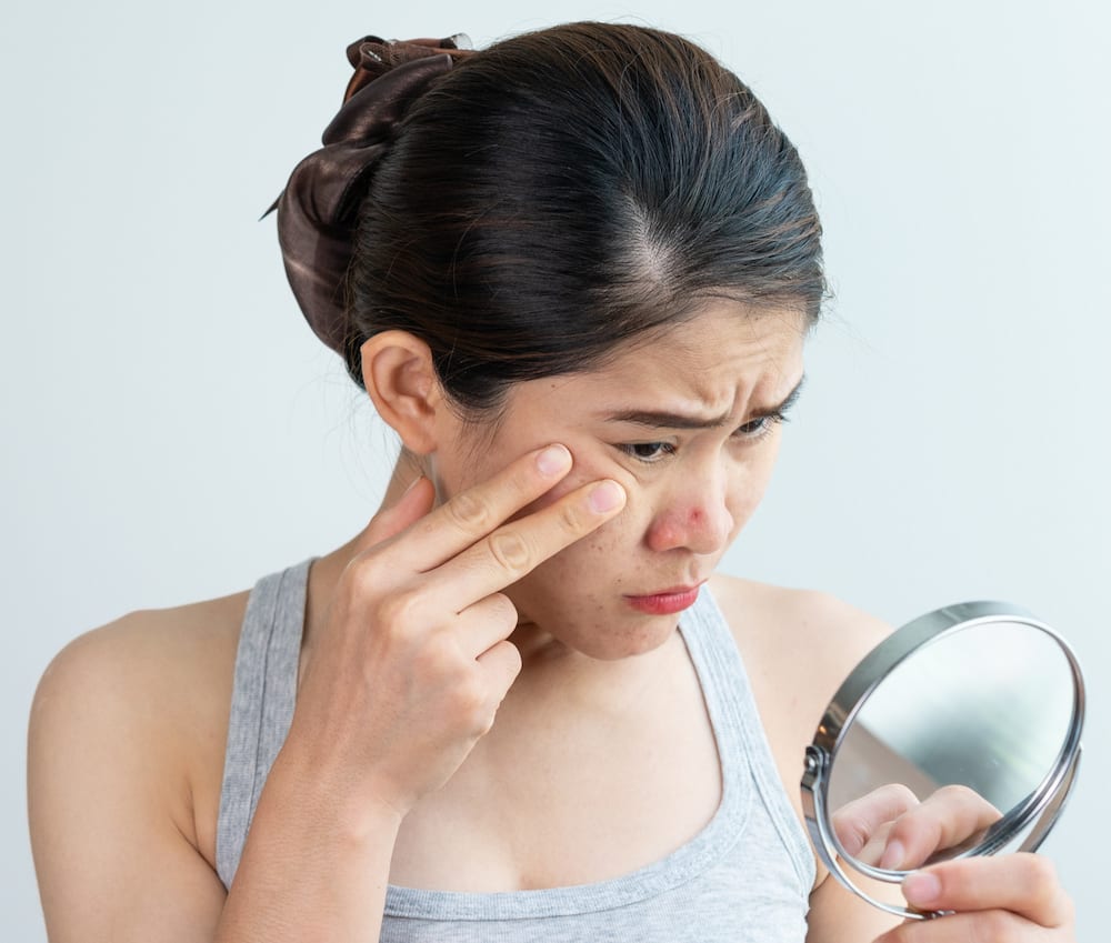 A woman looking at a skin breakout on her nose in the mirror