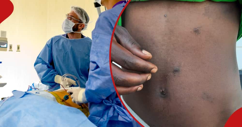 A kidney donor (right) shows the incision on his body. Doctors is an operating theatre (left)