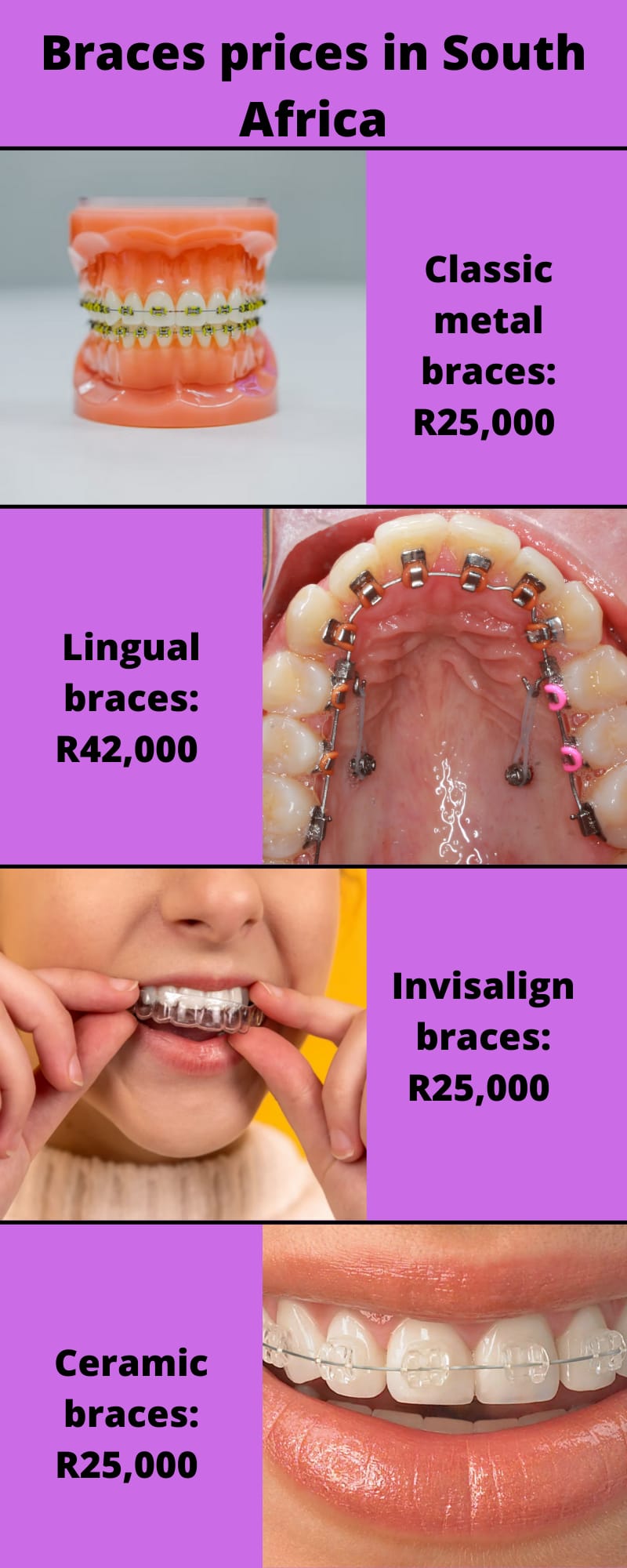 how much do braces cost in South Africa