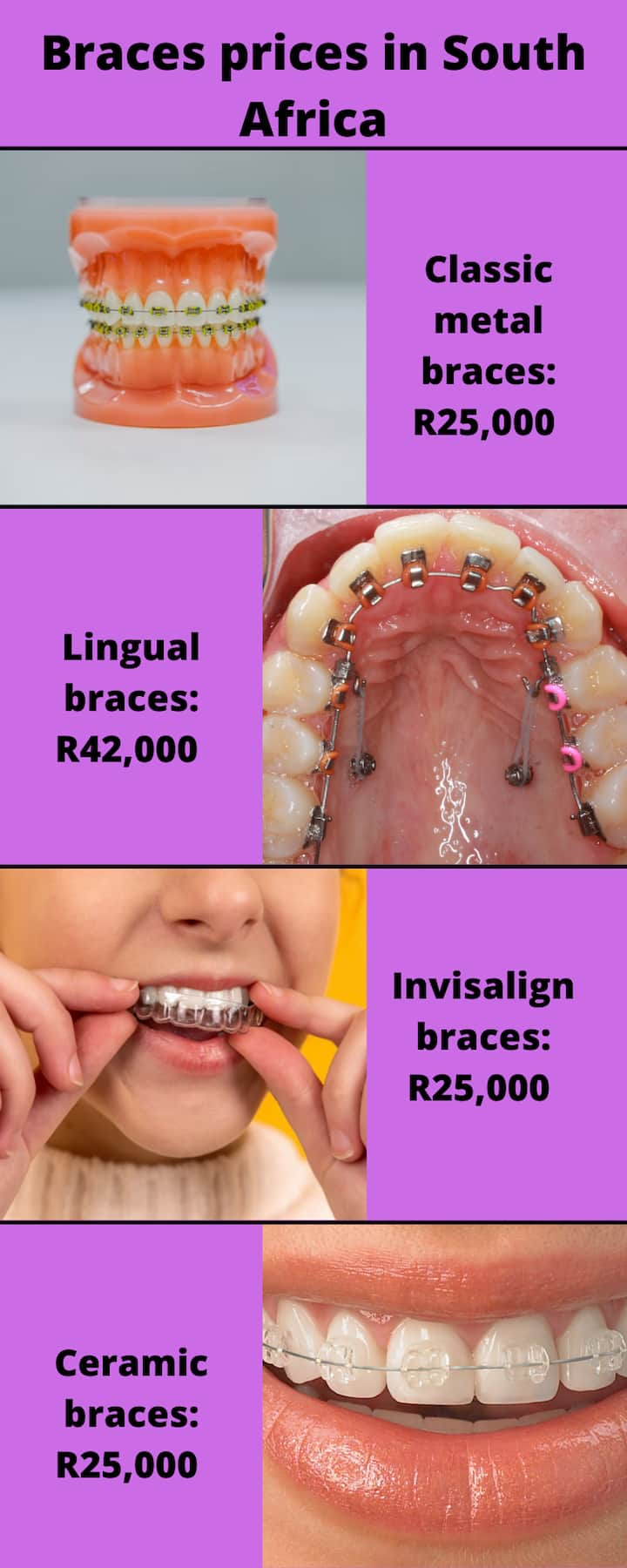 How much are braces in South Africa 2024? Braces price and infographic