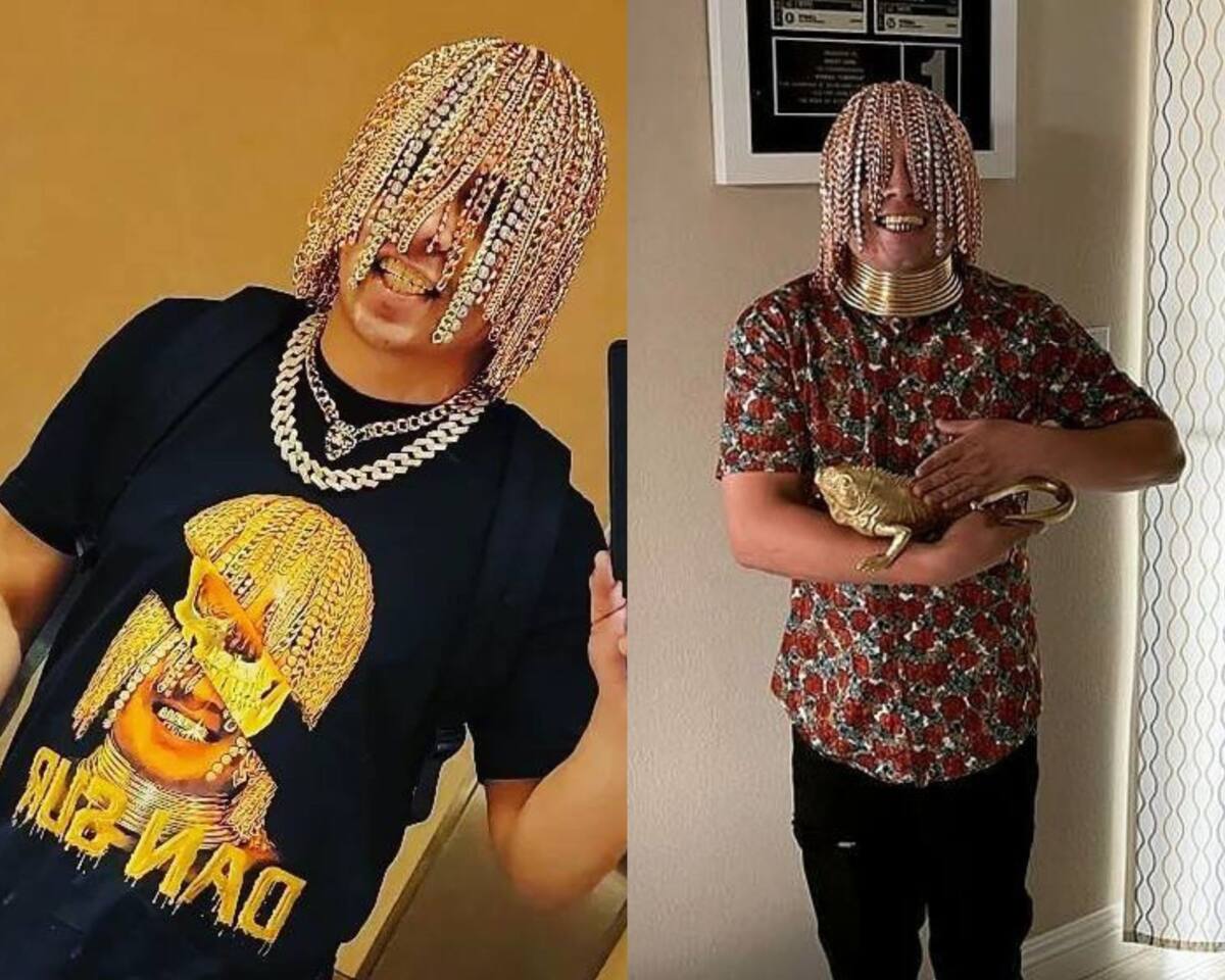 23-year old Mexican rapper named Dansur, surgically implants gold chains  into his head to serve