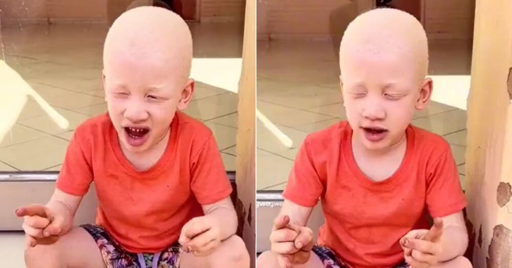 Boy with albinism opens up