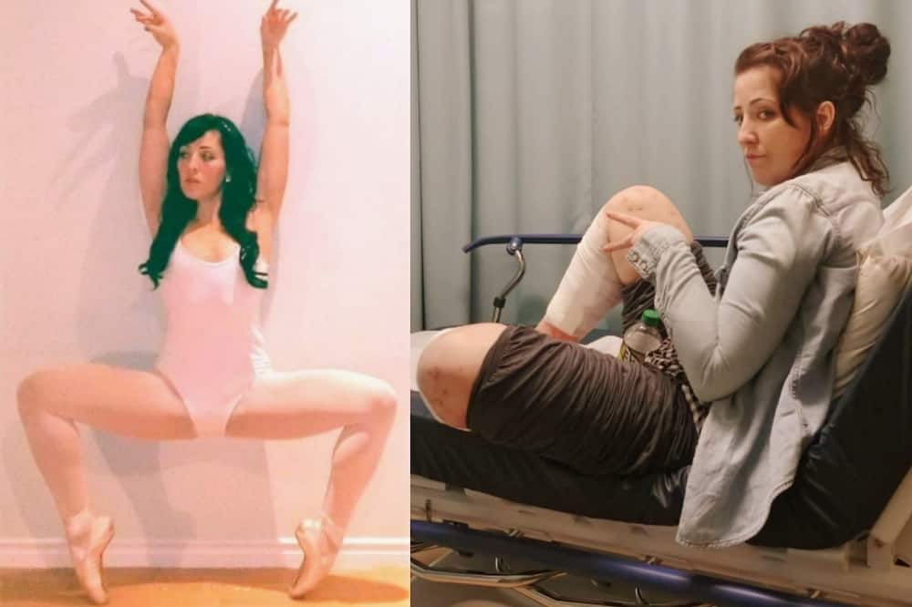 Kelly Ronahan used to be a ballerina as shown to the left, and to the right, she is sitting in a hospital bed with legs wrapped