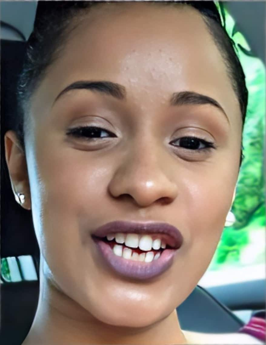 what happened to cardi b teeth