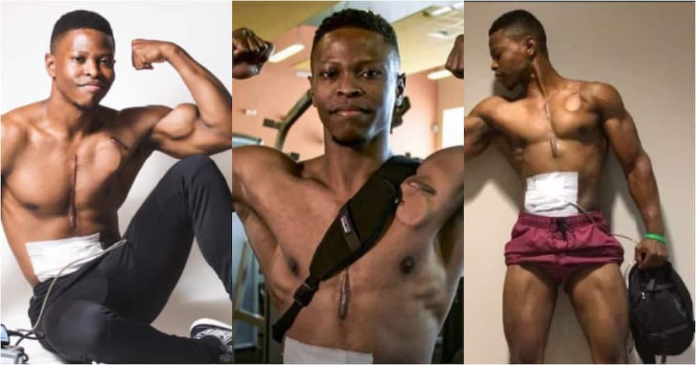 Andrew Jones: Meet the fitness model who walked with an artificial heart in his backpack for over 2 years