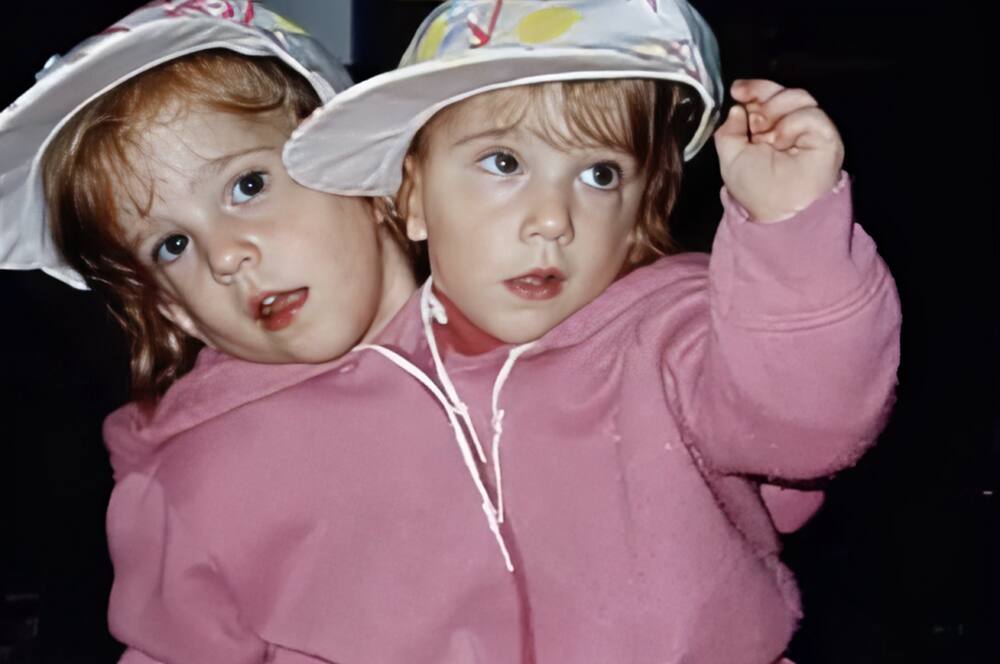 Conjoined twins Abby and Brittany Hensel: Where are they today? -  