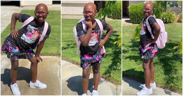 Mom Shows Off Beautiful Daughter With Alopecia Photos Of Girl