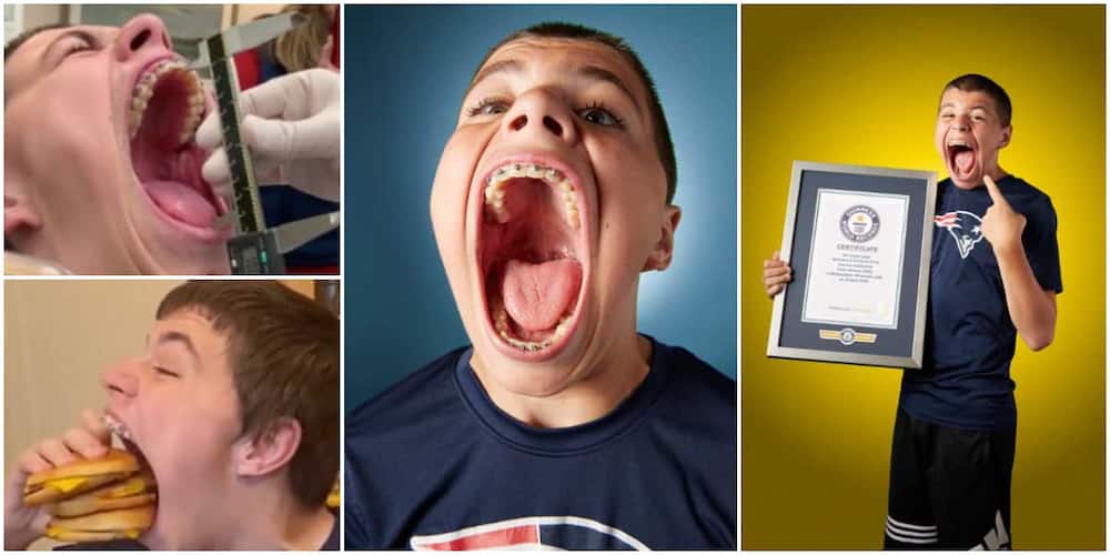 Teenage, boy, Guinness World Record, widest mouth