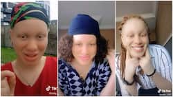 "I was not allowed to go out": Albino lady with perfect skin reveals how she became beautiful