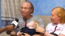Family of three living with albinism ask people to be more accepting