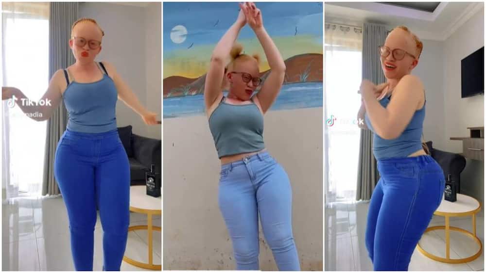 Albino girl with beautiful skin danced in video, attracting attention from TikTok