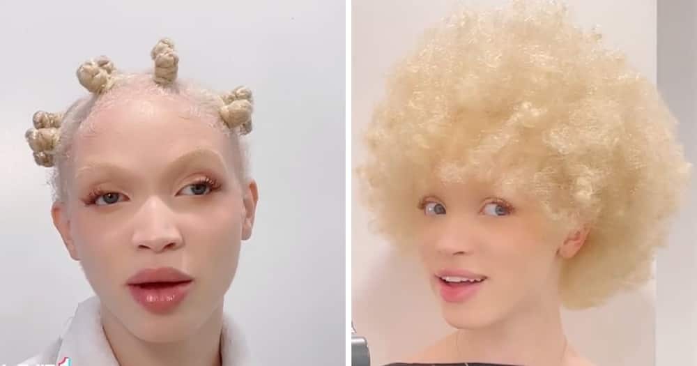 Model living with albinism rocks new hair-do