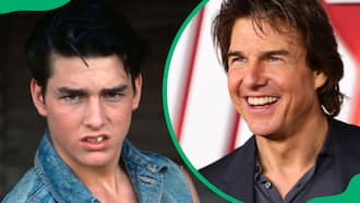 Tom Cruise’s teeth: How he went from dull to dazzling?