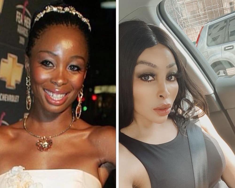 Khanyi Mbau plastic surgery photos