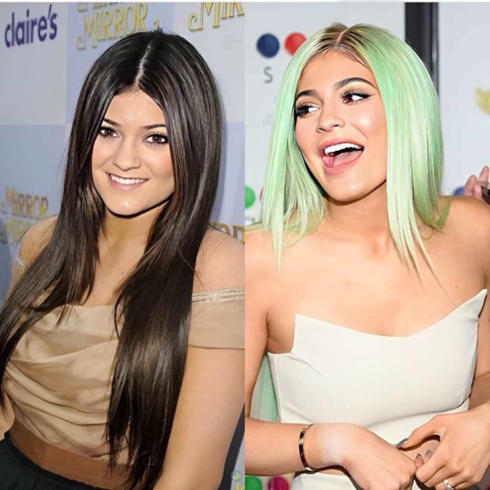 Celebrity veneers: Then and now photos of 30 biggest celebrity transformations