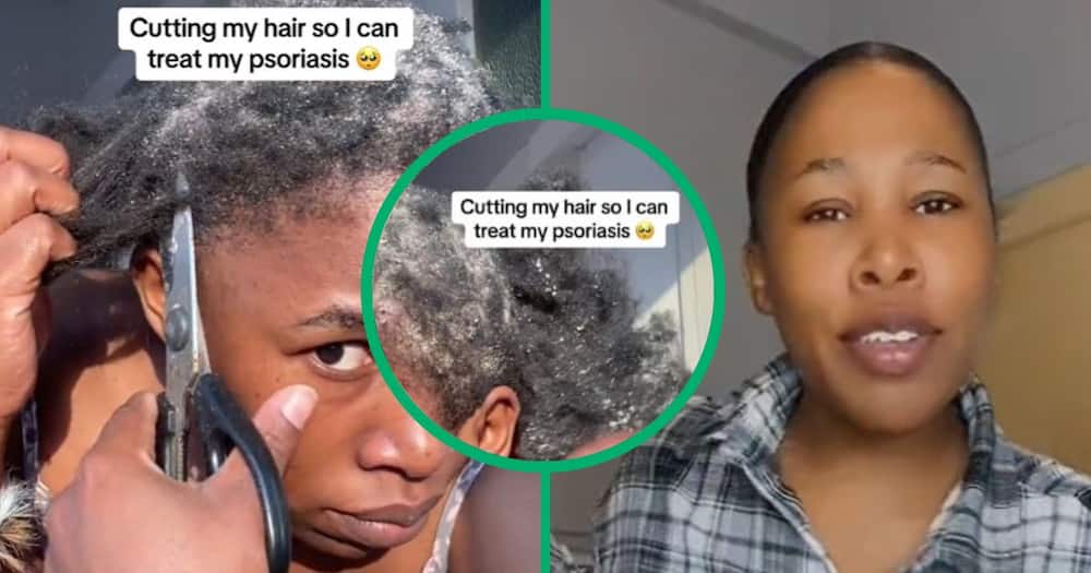 TikTok video of psoriasis sufferer cutting hair