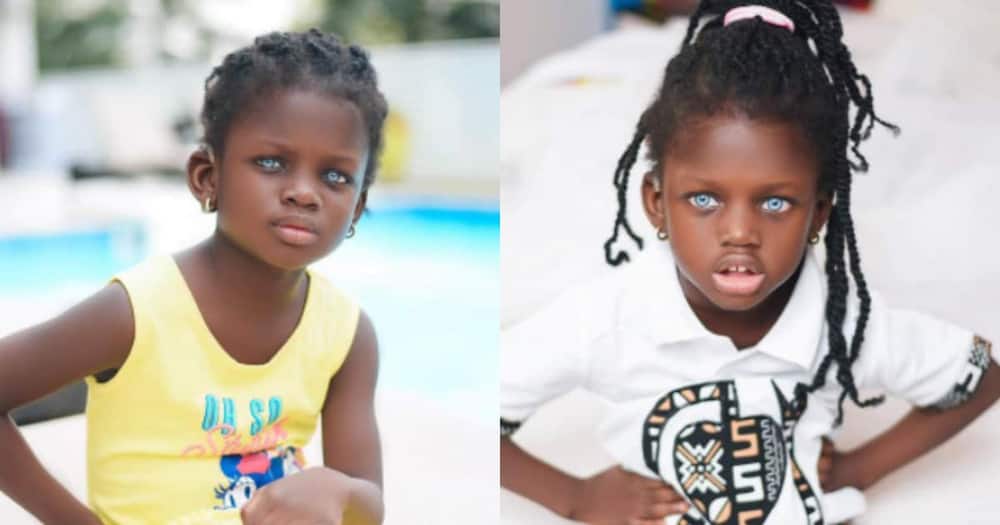 Rebecca Dumeh: Blue-eyed child modelling to raise funds and awareness for her condition