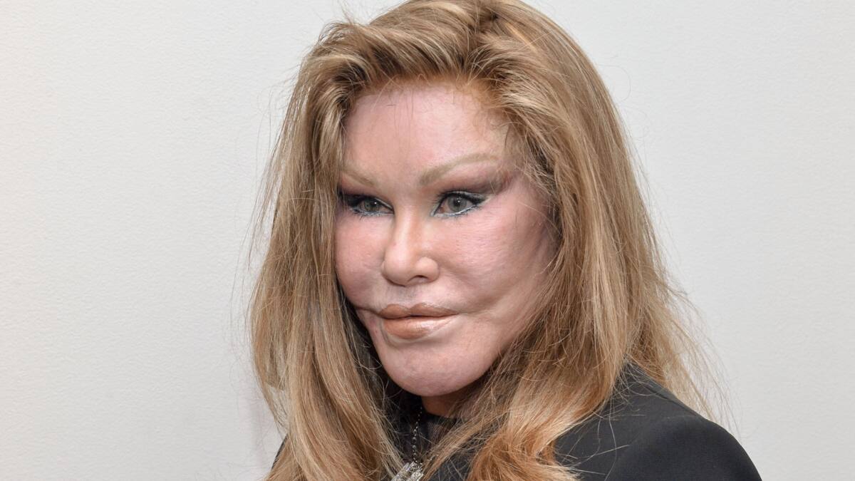 Jocelyn wildenstein age