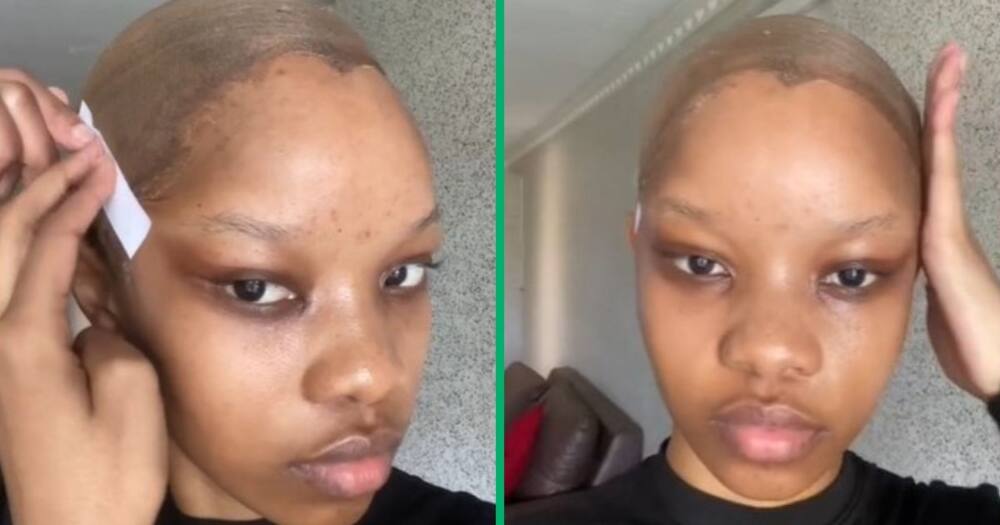 TikTok video shows woman's facelift before wig install