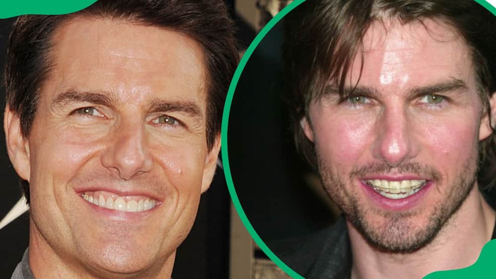 Tom Cruise wearing invincible braces at Grauman's Chinese Theatre (L). The producer attending an event at Ziegfeld Theater (R)
