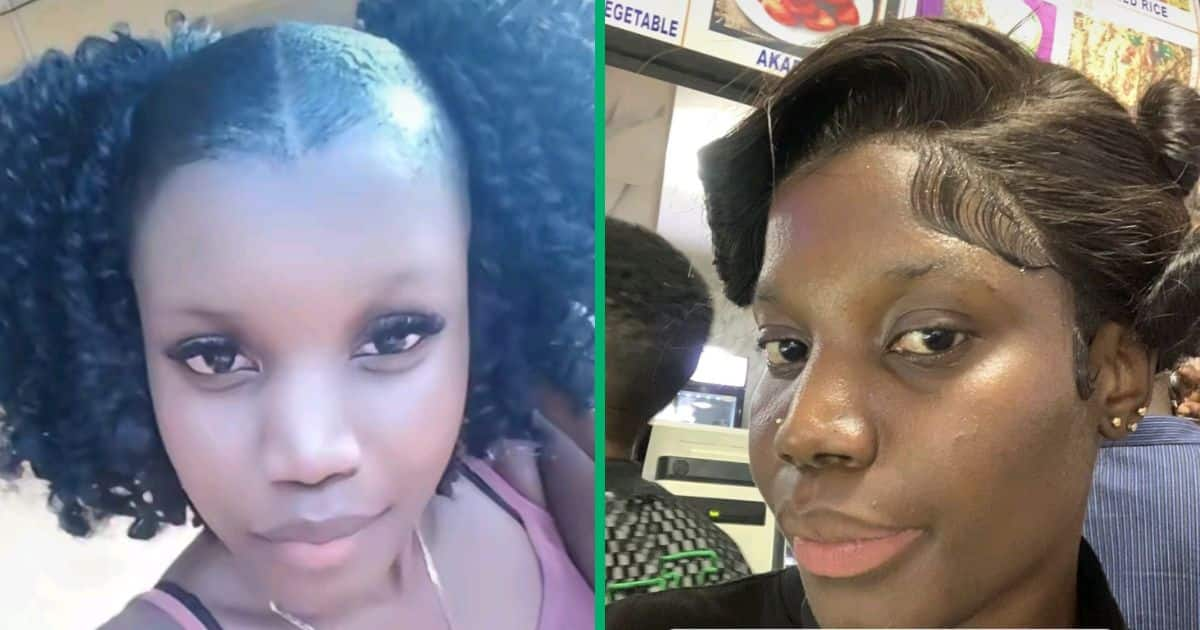 Nigerian Woman Shares Horrifying Skin Bleaching Journey With