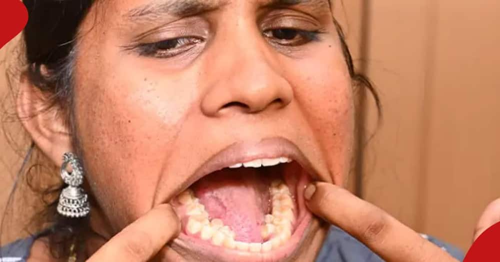 Woman with 38 teeth