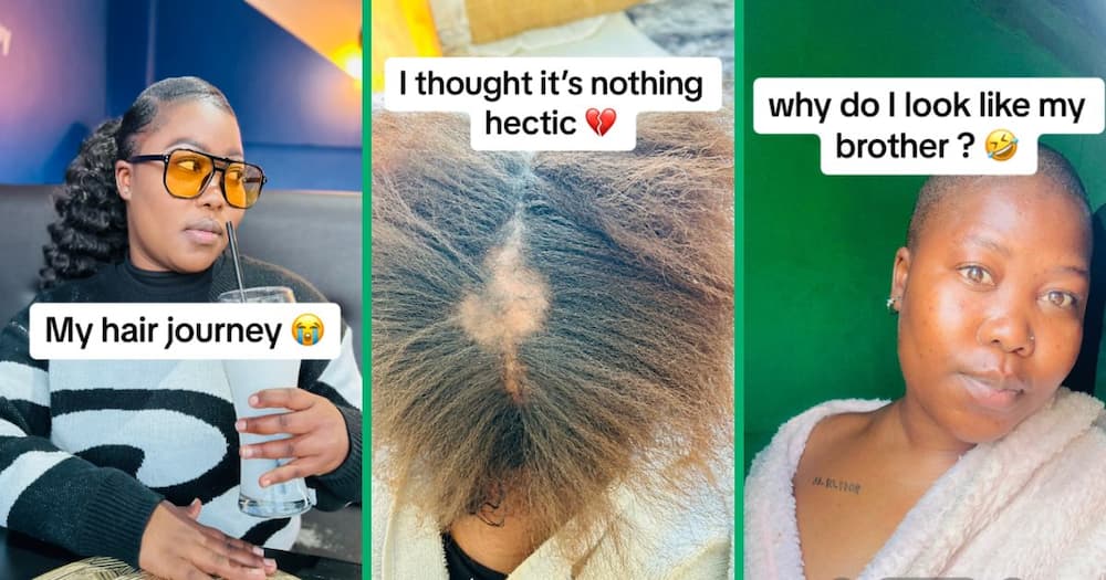 Woman opens up about hair loss journey