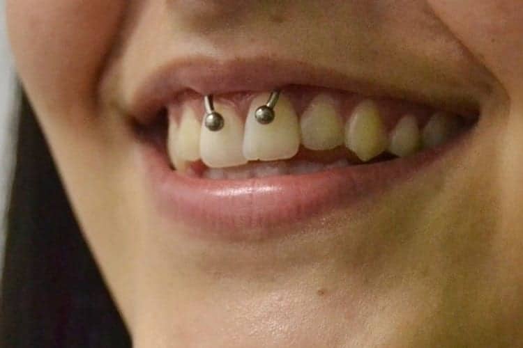 Are smiley piercings safe?