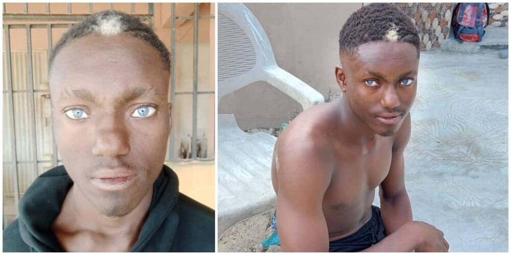 Young Man with Natural Light Blue Eyes and White Hairs in Front of His Head Goes Viral, Wows Many Young Man with Natural Light Blue Eyes and White Hairs in Front of His Head Goes Viral, Wows Many