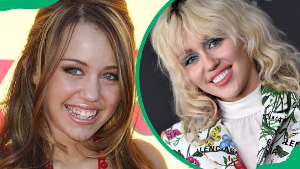 Miley Cyrus' teeth